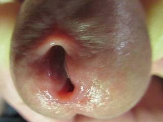My Big Peehole