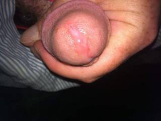 Starting to ooze abit any one wanna lick