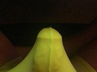 yellow bulge