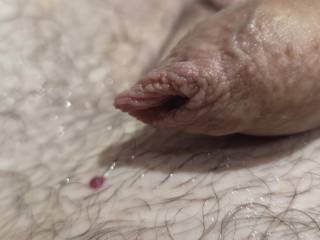 Foreskin