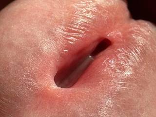 Penis tip.
