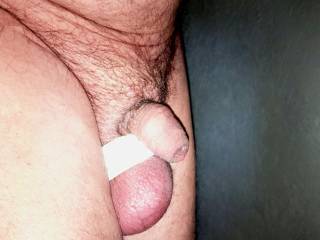 My swollen eggs.