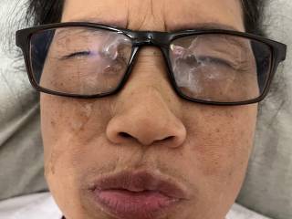 Glasses facial
