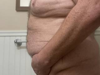 Pre fat skin removal surgery after losing 156lbs how do I look