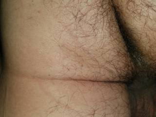 Hairy hole