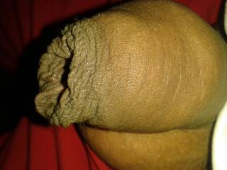 Un cut cock but i not have frenulum because one day i was  very very hot. i have very erected my cock when frenulum broken