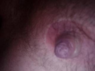 Just had my Nipple pulled