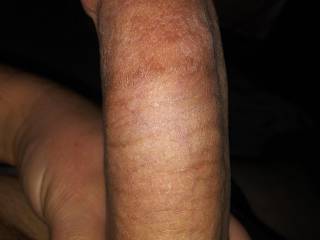 Side close up