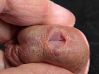 Photo of penis just before sounding session