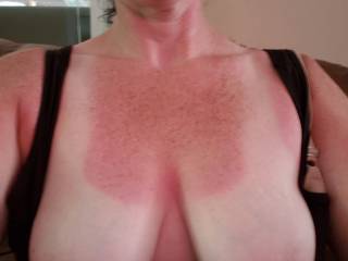 Got a little sunburn yesterday.  Hubby says semen will stop the stinging, does anybody want to spray me with theirs so I can rub it in?