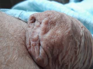 So ugly, yet turns into something  ?