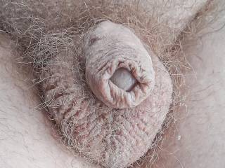 My erectile dysfunction dickie
Not shaved