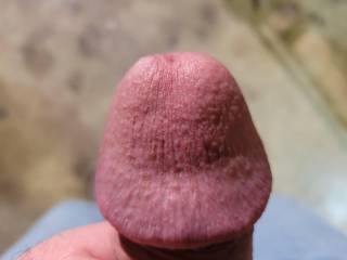 Really swollen