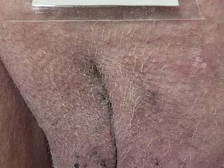 I think its time for hubby to give me a shave ?