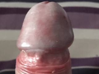 Zoig friend Sandy wants to see my Tip not my foreskin