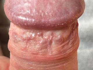 Mr Stiffie\'s exposed swollen head ready for your enjoyment.