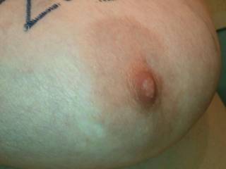 My nipple