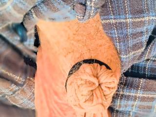 Friend playing around whit my skin what would you do? Lov to hear ❤️