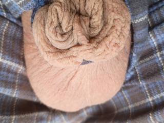 A few skin fir my friend