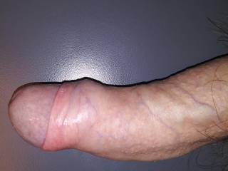 Foreskin partially retracted with some glans showing.