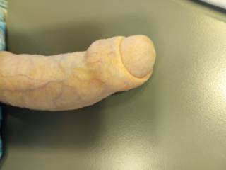 Foreskin partially  retracted.