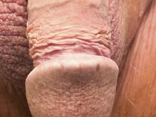 Photo of penis "head on"