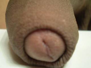 I love being uncut!!!!!