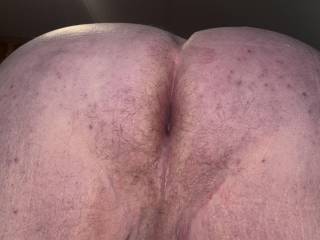 Not sure I can get much closer but I’ll try if you want. Guess I should spread my asdhoke open next time.