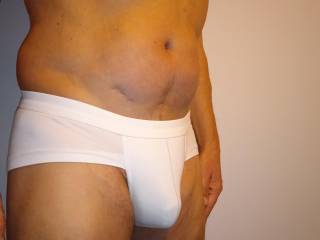 White bulge