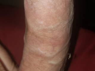 Hard