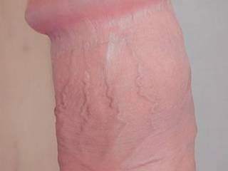 My penis