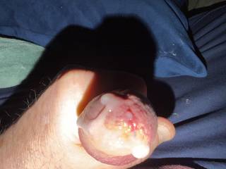 Anyone want to lick it!