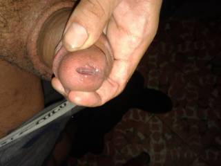 open glans