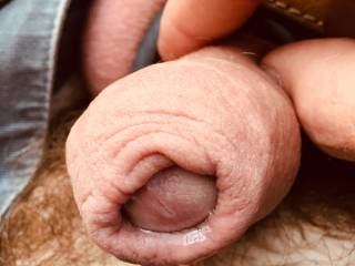 Thick foreskin x