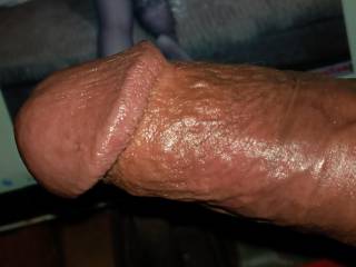 head of penis and veins
