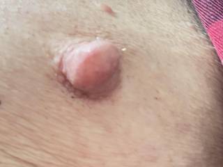 My nipple