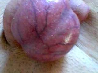 Out of Lovolust\'s Blusheroticon; subject: My living meat balls (5)! The most hardened and most al-dente ballsack! The extraordinarily wrapped pack! Without cord - real, unfaked, true, genuine pix - from funny up to sexy-porny; it is for the Women!