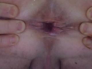 Asshole Opening For Your Penetrating Pleasure....💦👅💦👅💦😋😛👌👍👏😜😜😜
