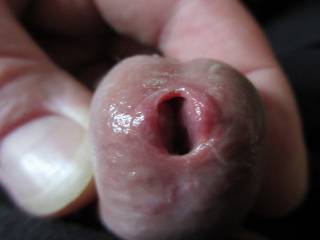 My Peehole