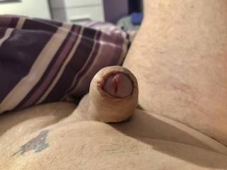 Id love my foreskin puled back  and then my cock made to cum