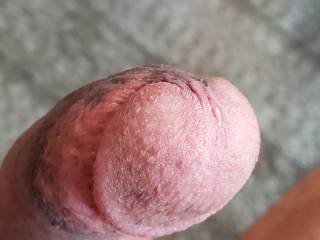 Needs to be sucked often