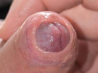 Dick pic