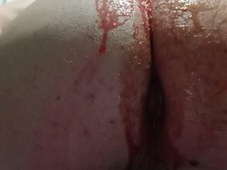 My Ass, Asshole and Balls Covered in My Ice Lolly Juice....Lick Me Clean if You Like  ?....🤔🤔🤔