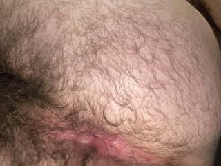Spreading and exposing my hairy furry hole