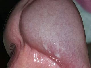 close up of my dick head
