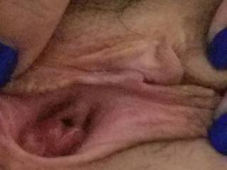 So close you can see my p hole