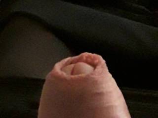 Would you like to work on my foreskin.