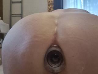My hole filled