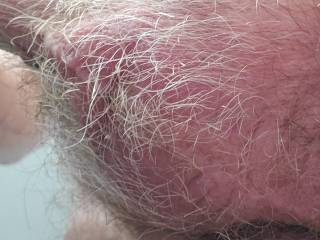 Hairy balls