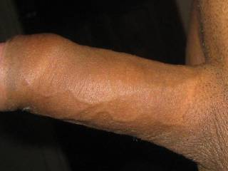 Dick